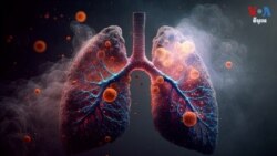 Hello VOA សុខភាព៖ ការជក់បារីអាចនាំឱ្យមានជំងឺមហារីកច្រើនប្រភេទ