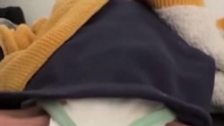 Anak-Anak di Gaza Menderita Kekurangan Gizi