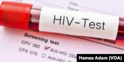 Tes HIV/AIDS. (Foto: VOA)