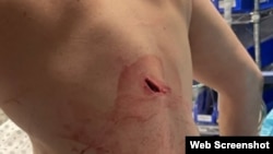 Lui Suljović u bolnici u Kvinsu (Photo: Louie Suljevic)