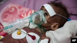 FILE - A malnourished girl receives treatment at a feeding center at Al-Sabeen hospital in Sanaa, Yemen, Nov. 3, 2020. 