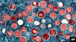 រូបឯកសារ៖ រូបភាព​មីក្រូស្កូប​បង្ហាញ​កោសិកាដែលត្រូវបាន​ឆ្លងជំងឺអុតស្វាយ កាលពីថ្ងៃទី២៥ ខែឧសភា ឆ្នាំ២០២៣។