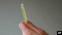 Tim peneliti Amerika dan Brazil mengembangkan kombinasi tes papsmear yang juga dapat mendeteksi dua jenis tumor ginekologi yang sulit dikenali dan berpotensi mematikan (foto: Dok).