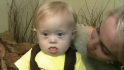 科学家正在研发检测唐氏综合症的手机应用