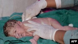 FILES - In this file photo taken on May 12, 2016 a Pakistani doctor cleans a newborn baby after his birth at a hospital in Muzaffarabad.