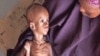 Liên Hiệp Quốc dự báo nạn đói sẽ lan tràn khắp Somalia