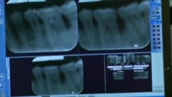 牙医用钻的日子有望成为过去