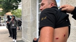 Demonstrant povrijeđen gumenim metkom (Foto: Rojters/Stevo Vasiljevic)