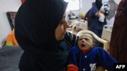 Palestinska beba, koja pati od neuhranjenosti, u bolnici u Rafi, mart 2024. (MOHAMMED ABED / AFP)