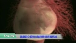 健康的心脏和大脑将降低失智风险