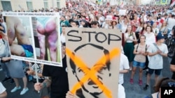 白俄罗斯民众8月17日在首都明斯克街头示威，要求卢卡申科总统下台，抗议警察暴行。