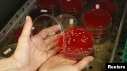 Seorang petugas memperlihatkan bakteri 'superbug' di sebuah laboratorium mikrobiologi di Berlin, Jerman.