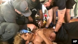 បុរស​ម្នាក់​ត្រូវរបួស​ដោយការ​ប្រយុទ្ធ​នៅ​រដ្ឋ Karen មីយ៉ាន់ម៉ាកាលពីថ្ងៃទី​៣១ មីនា ឆ្នាំ២០២៤។