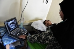 Seorang dokter melakukan USG pada seorang ibu yang sedang hamil di Klinik ASRI di Sukadana, Kalimantan Barat. (Foto: AFP/Bay Ismoyo)