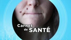 Carnet de Santé : les grains de beauté et les taches cutanées