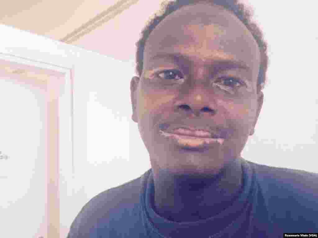 Un autre homme a eu son visage brûlé par les passeurs en tentant de rejoindre la Libye pour prendre un bateau pour l&#39;Europe. Cette image a été obtenue par VOA Afrique auprès d&#39;un médecin italien de Milan qui soigne les migrants dans un centre d&#39;accueil. &nbsp;