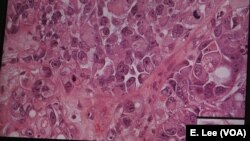 Kecerdasan buatan dapat mendeteksi pola kompleks dalam pengaturan sel yang akan sulit dikenali manusia.