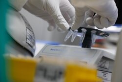 Seorang peneliti sedang melakukan penelitian sampel untuk mengembangkan vaksin virus corona (Covid-19) di laboratorium perusahaan bioteknologi, BIOCAD, di Saint Petersburg, Rusia, 11 Juni 2020. (Foto: Reuters)