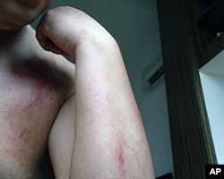 刘飞跃挨打受伤