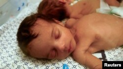 Nedonošče iz bolnice Al Šifa u porodilištu u Rafi (foto: Rojters/Ibraheem Abu Mustafa)
