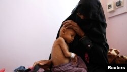 Ibu dari Radhi Awadh, 2, memeluk putranya yang dirawat di ruang perawatan malnutrisi di Rumah Sakit al-Sabeen di Sanaa, Yaman, pada 13 Februari 2021. (Foto: Reuters) 