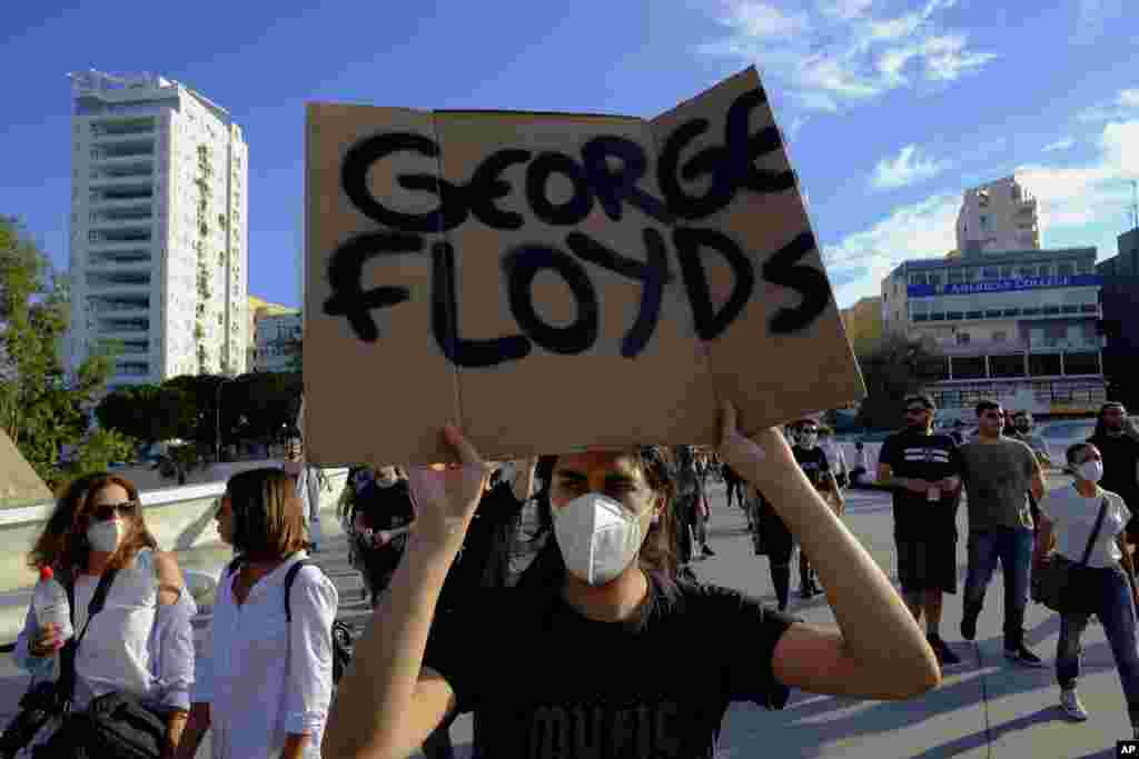 បាតុករ​ម្នាក់​ដែល​ស្ថិត​ក្នុង​ចំណោម​អ្នក​ដើរក្បួន​គាំទ្រ​ដល់​ជន​ចំណាកស្រុក​ដែល​ត្រូវ​បាន​ឃុំខ្លួន​នៅ​ប្រទេស​ស៊ីប (Cyprus) បាន​កាន់​បដា​ដែល​មាន​សរសេរ​ឈ្មោះ​លោក George Floyd ដើម្បី​បង្ហាញ​ពី​សាមគ្គីភាព​របស់​ពួកគេ​ដល់​លោក George Floyd ដែល​បាន​ស្លាប់។ ការ​ដើរក្បួន​នេះ ធ្វើ​ឡើង​នៅ​រដ្ឋធានី Nicosiaនៃ​ប្រទេស​ស៊ីប​ នៅ​ថ្ងៃអាទិត្យ​ទី ៣១ ខែឧសភា ឆ្នាំ ២០២០។ (AP)
