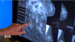 តើ​បញ្ញាសប្បនិម្មិត​ AI អាច​កំណត់​រក​ជំងឺមហារីក​សុដន់​បាន​ប្រសើរ​ជាង​វេជ្ជបណ្ឌិត​ឬ​ទេ?